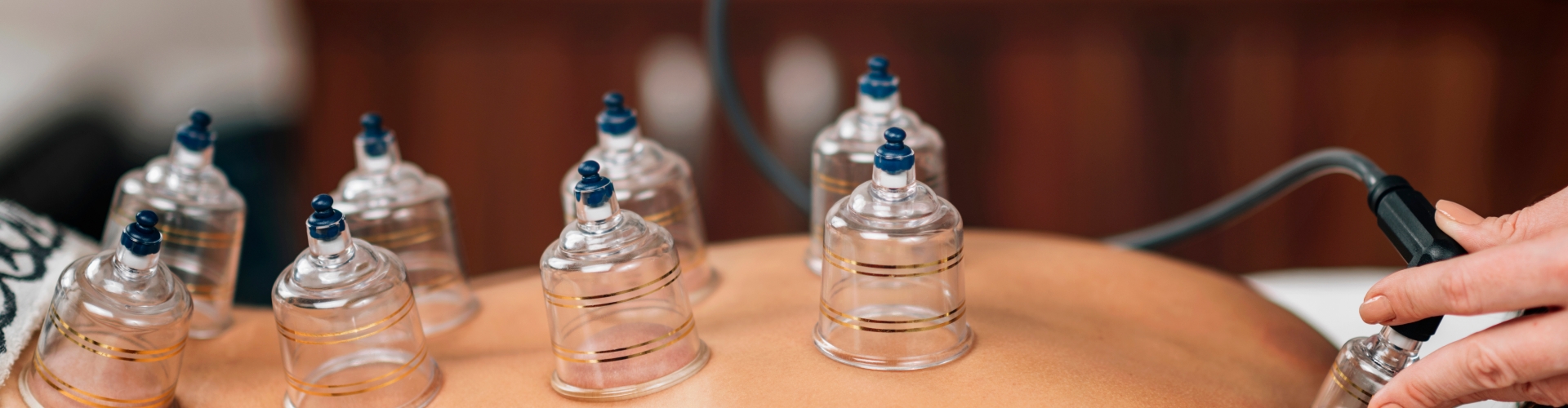 cupping-Precizion-Performance-Lab-Lake-Cucomonga-CA-header