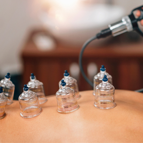 cupping-Precizion-Performance-Lab-Rancho-Cucomonga-CA