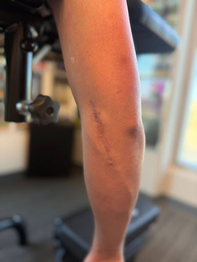 post-surgical-rehab-homepage-precizion-physical-therapy-rancho-cucamonga-ca