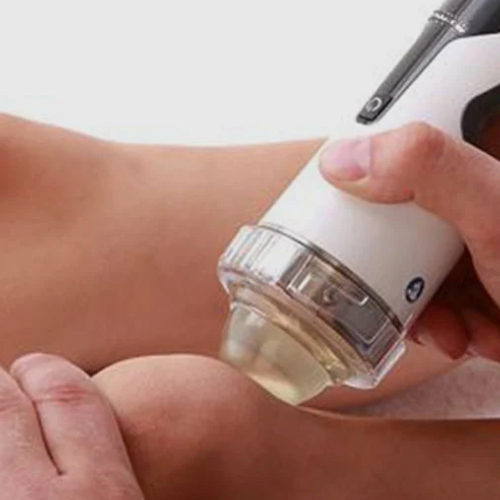 regenerative-medicine-knee-Precizion-Performance-Lab-Rancho-Cucomonga-CA