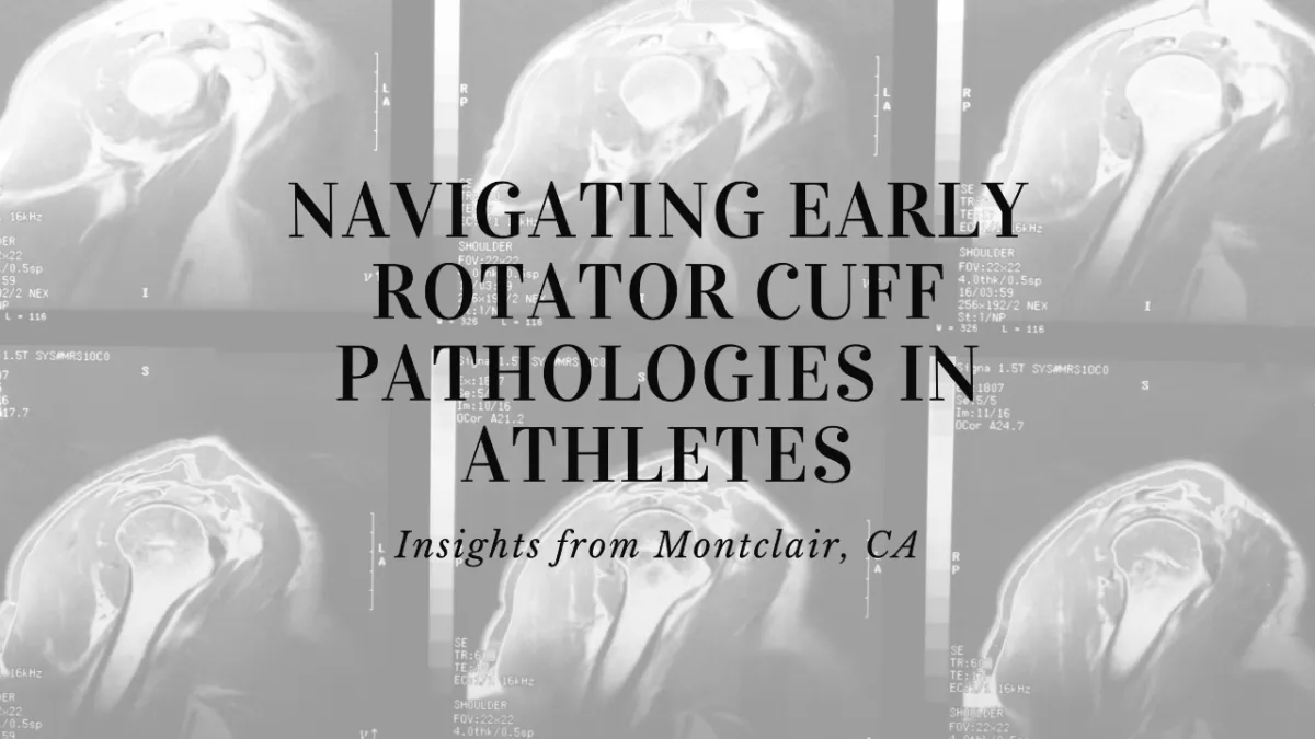 Navigating Early Rotator Cuff Pathologies in Athletes: Insights from Montclair, CA