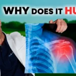why-does-it-hurt-Precizion-Performance-Lab-Rancho-Cucomonga-CA-banner